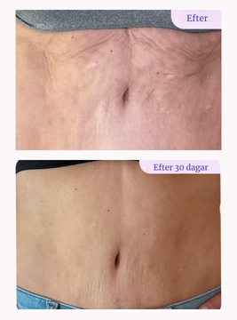 GoPure™ Smooth Belly Cream