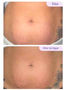 GoPure™ Smooth Belly Cream